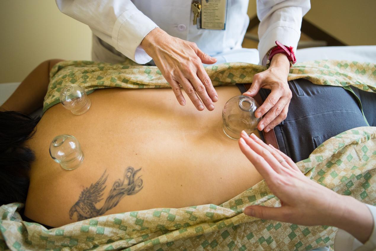 patient with cupping treatment